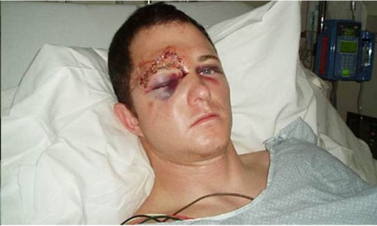 A fake image claiming to show injuries sustained by Ferguson Police officer Darren Wilson emerged online before being exposed as a hoax