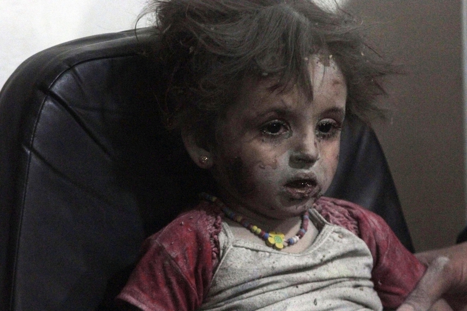 Injured Girl Child Syria Airstrike