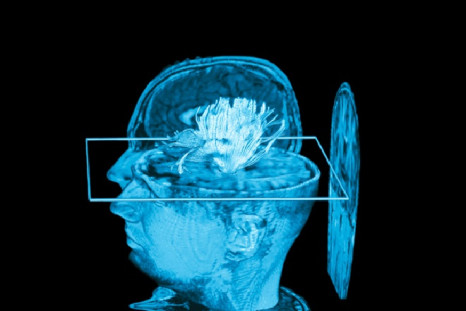 mind reading MRI