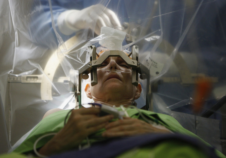 BRAIN.STIMULATION BRAIN.STIMULATION