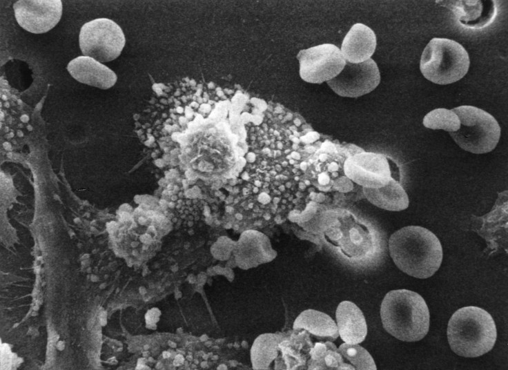 Macrophages