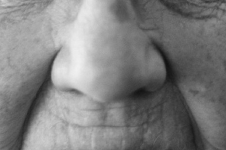 nose