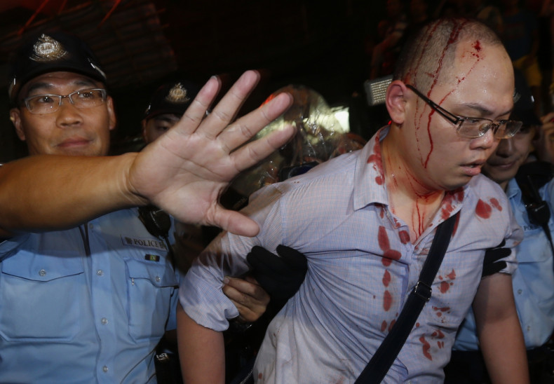 An injured pro-democracy protester is led away by police in Hong Kong
