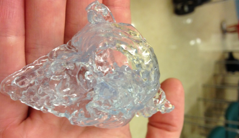 The 3D-printed model of the heart of a two-week-old baby born with a severe congenital heart defect