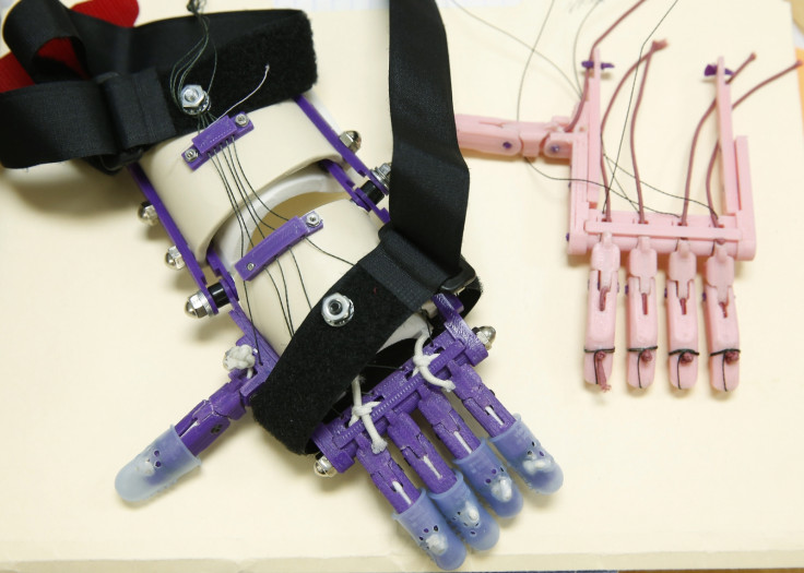 PROSTHETIC HAND