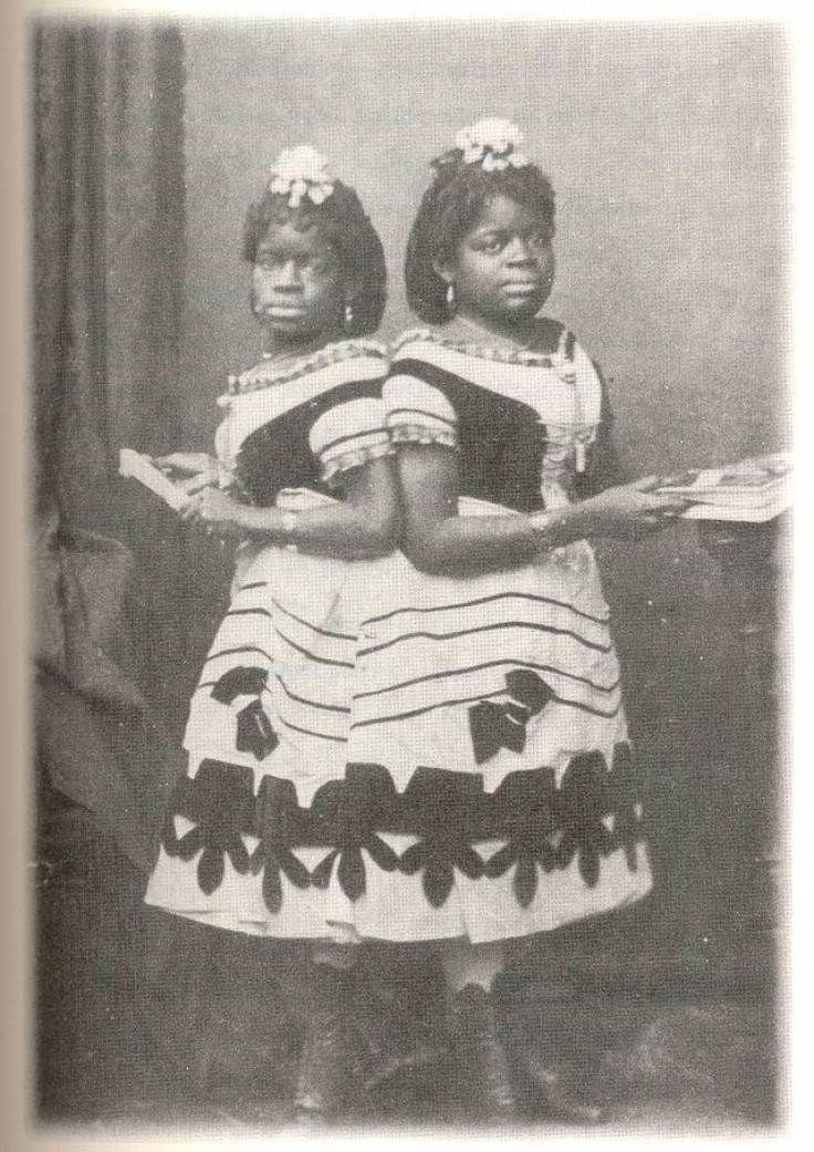 Millie and Christine McCoy in 1873