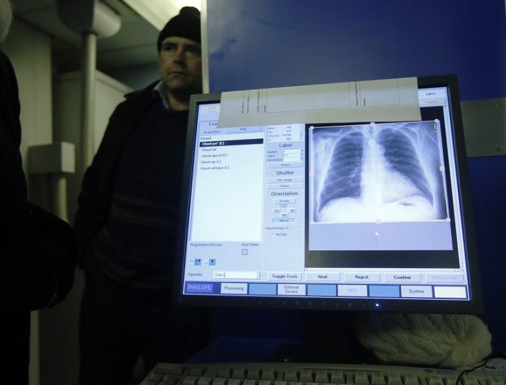 A patient's X-ray scan from a TB examination in a mobile screening unit in London's Ladbroke Grove