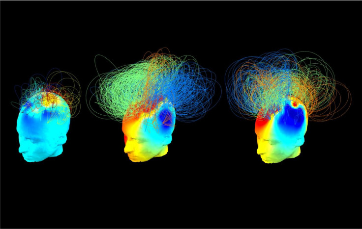 Brain activity scan