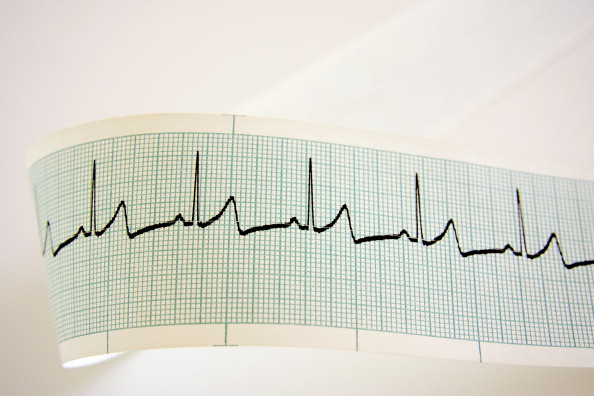 Heartbeat