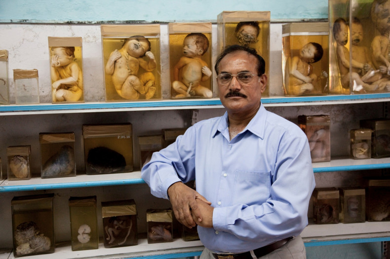 Bhopal foetuses