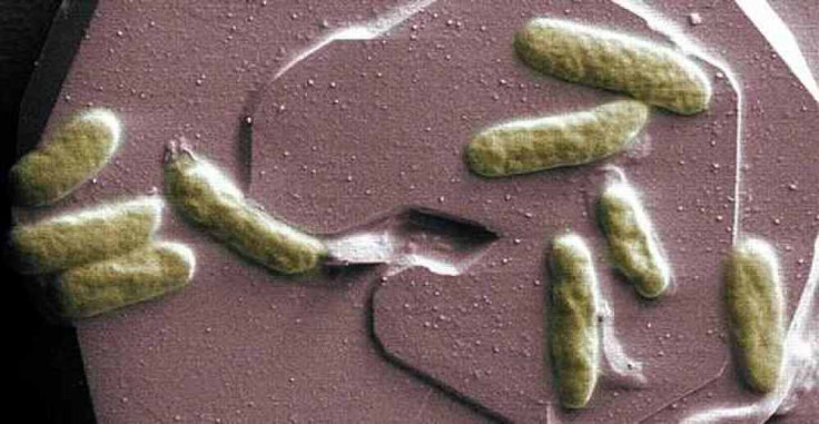 The Shewanella oneidensis bacteria - a type of bacteria that eats iron minerals and breathes out electricity