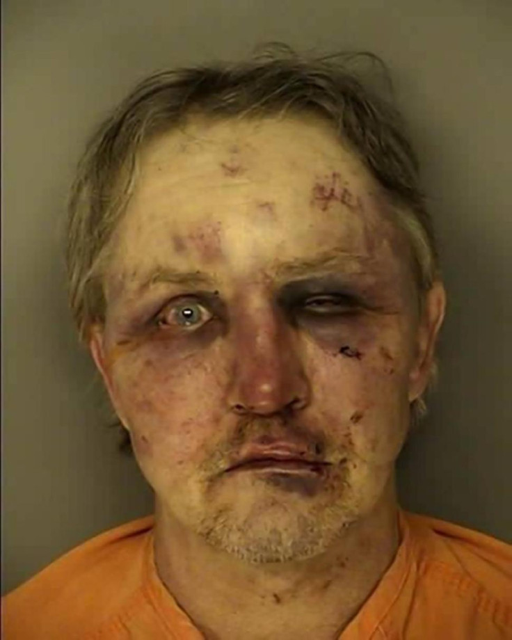 William Mattson after the attack. (Conway Police Department)