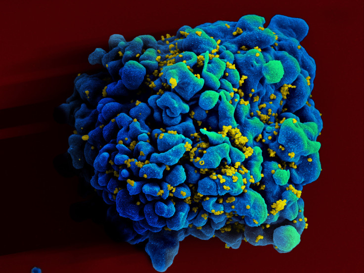 Scientists have discovered how to get immune T cells to locate and destroy mutated HIV