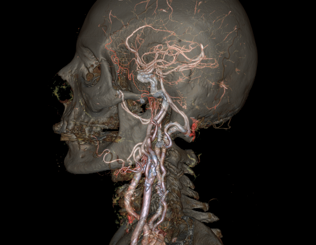 Revolution CT scanner reveals 'detailed' animated 4D models of organs