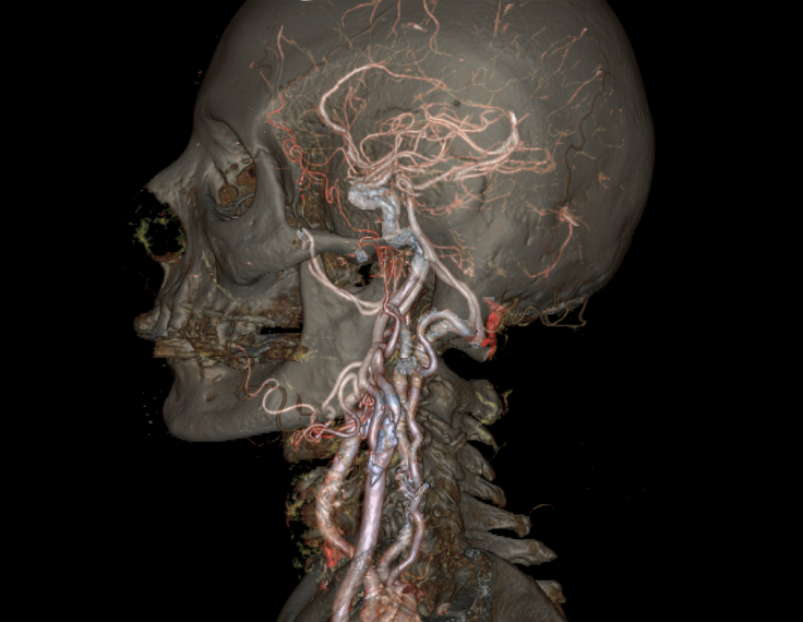A new CT scanner called Revolution CT can show animated moving 4D models of any part of the human body in a fraction of a second