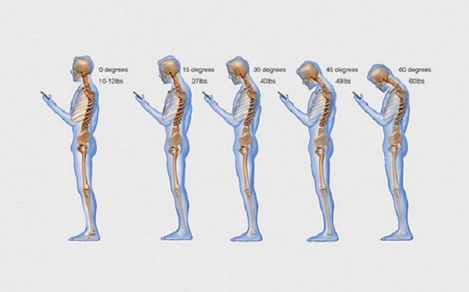smartphone posture tech neck