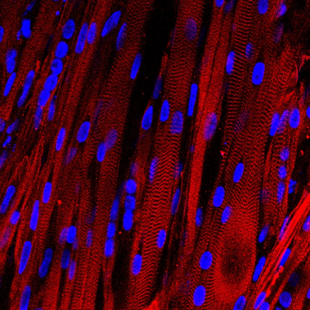 Human skeletal muscle grown in lab behaves like real tissue