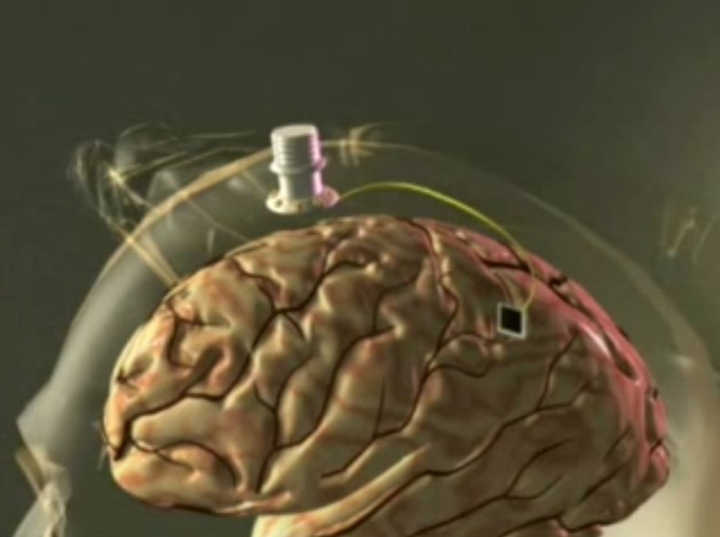 braingate wireless computer brain interface