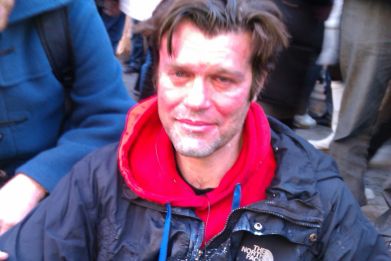 Uk Uncut activist Mike Firth after police hit him with CS spray during protest