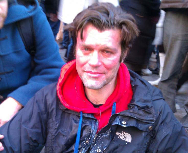 Uk Uncut activist Mike Firth after police hit him with CS spray during protest