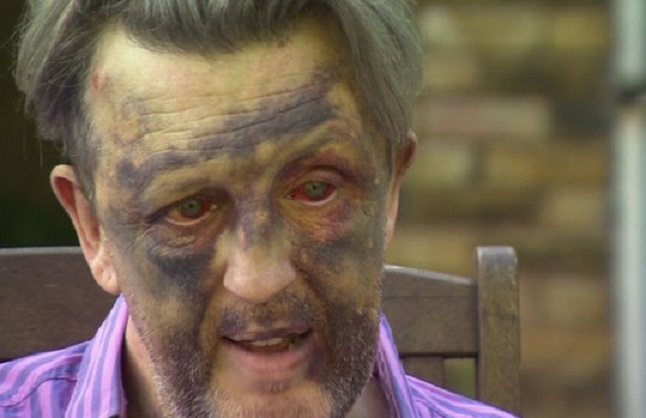 Paul Kohler was left with ghastly injuries by attackers in his Wimbledon home Paul Kohler was left with ghastly injuries by attackers in his Wimbledon home