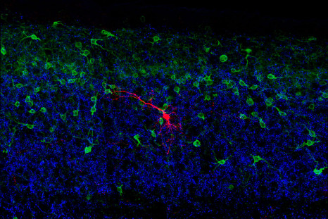TOUCH NEURONS