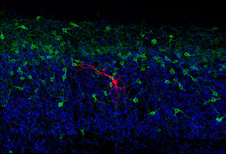 TOUCH NEURONS