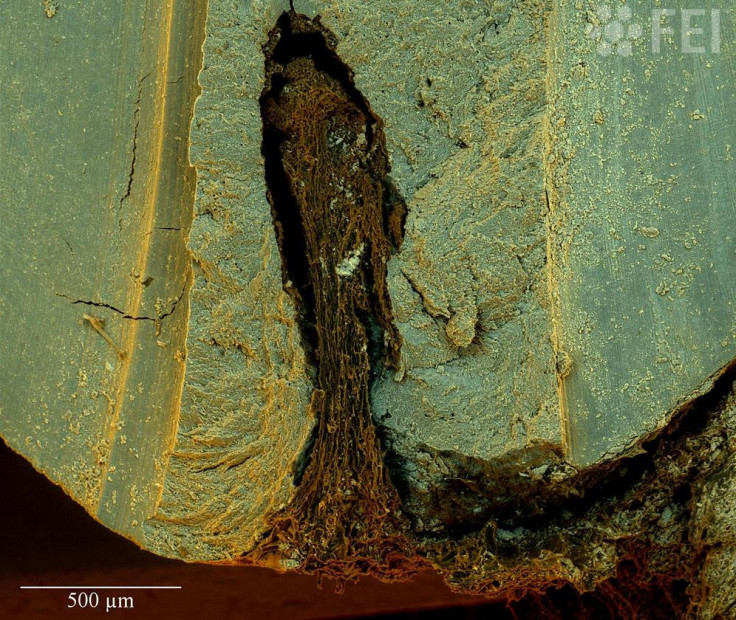 This is what a root canal looks like in high resolution