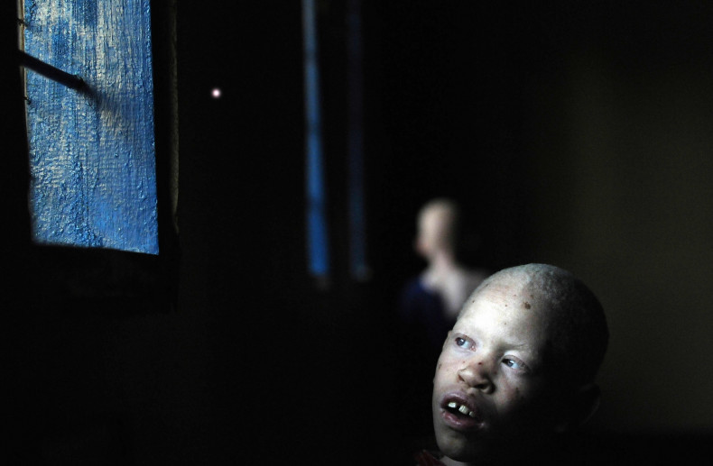 An Tanzanian albino child in school. At least 43 albino children have been murdered since the start of the century. (Getty)