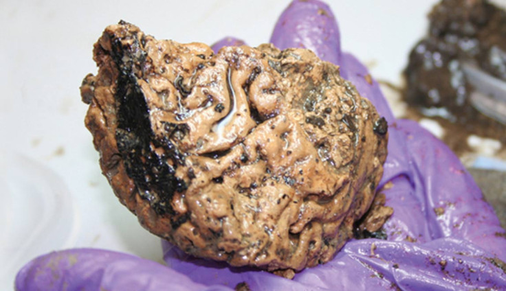 The best preserved brain in Britain.