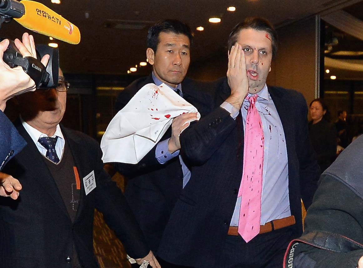 US ambassador South Korea Mark Lippert attacked