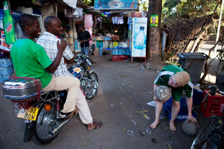 Albino child Tanzania