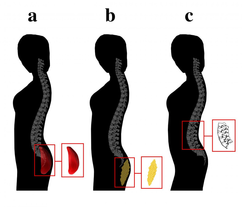 spinal curve