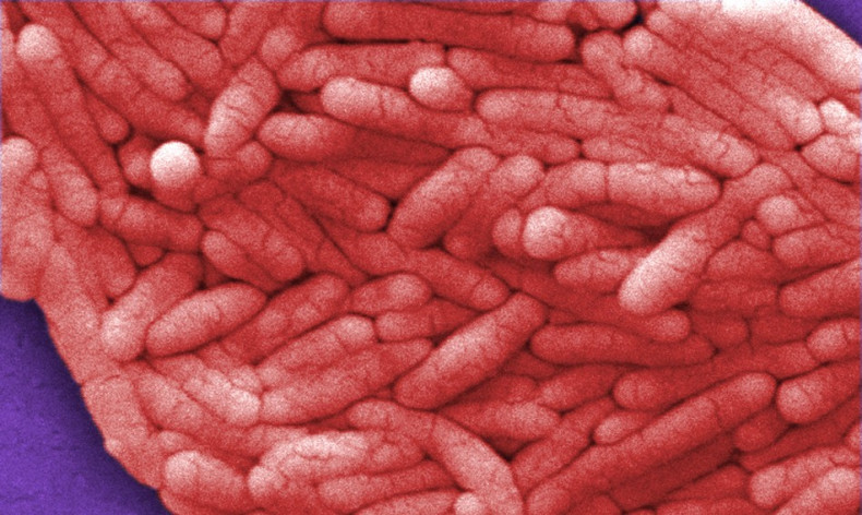 File photo of salmonella bacteria