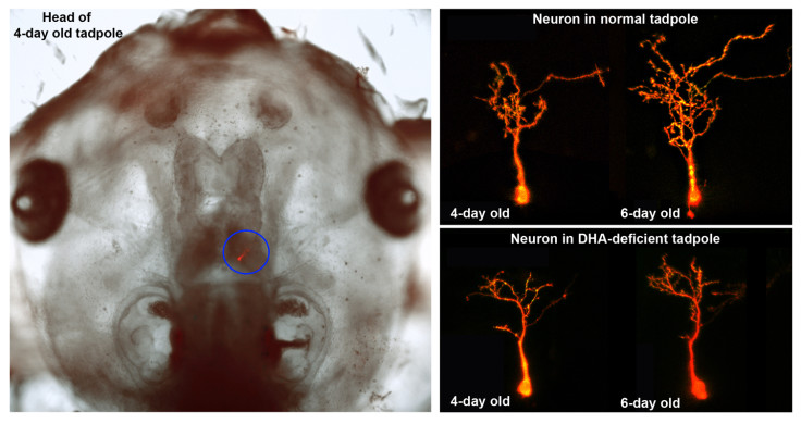 TADPOLE BRAIN