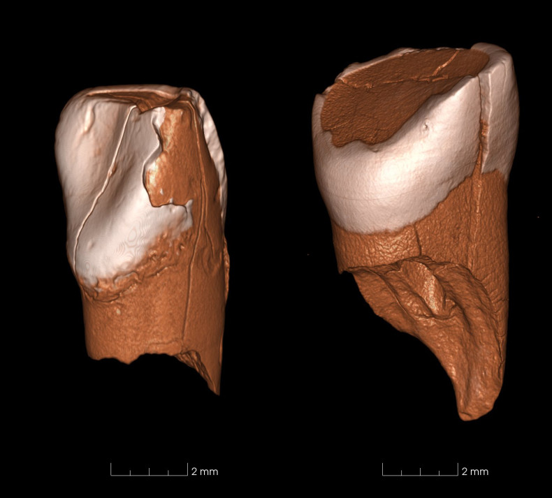 Protoaurignacian teeth mystery species