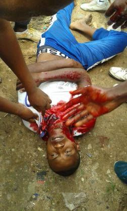 Burundi violence