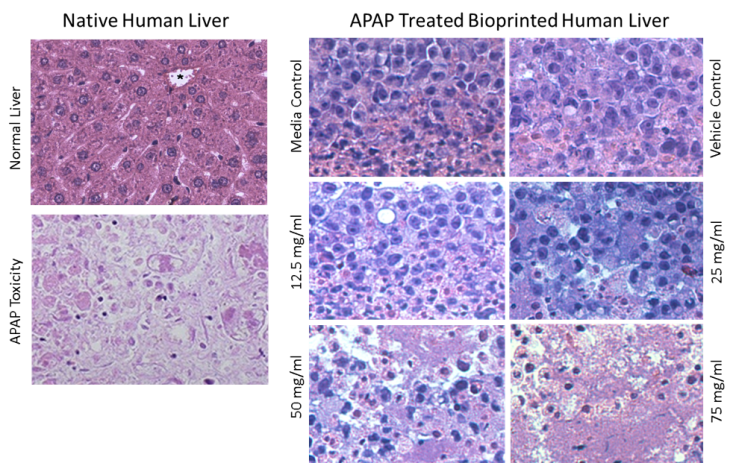 Organovo exVive3D Liver Model