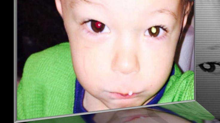 toddler's eye cancer
