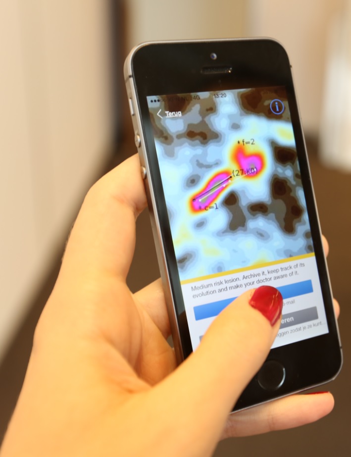 Skin cancer detection app SkinVision now as 'accurate as a dermatologist'