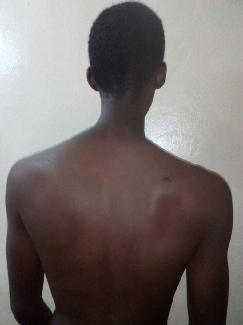 Burundi protester torture