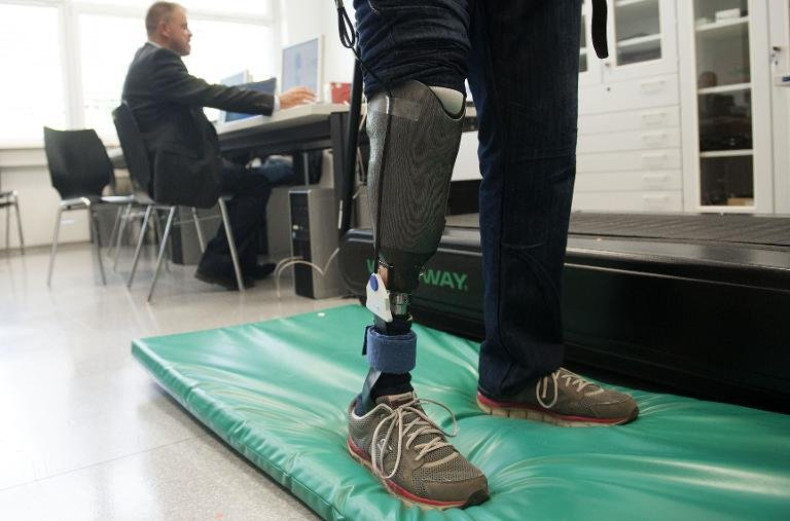 leg prosthesis artificial limb bionic
