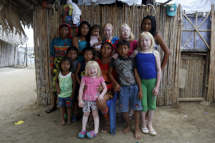 albinos Panama
