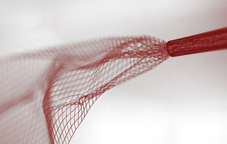 Neural lace has been invented to organically connect your brain with a computer