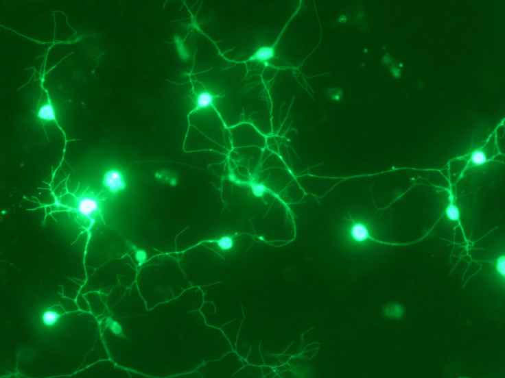 artificial neuron brain parkinsons disease