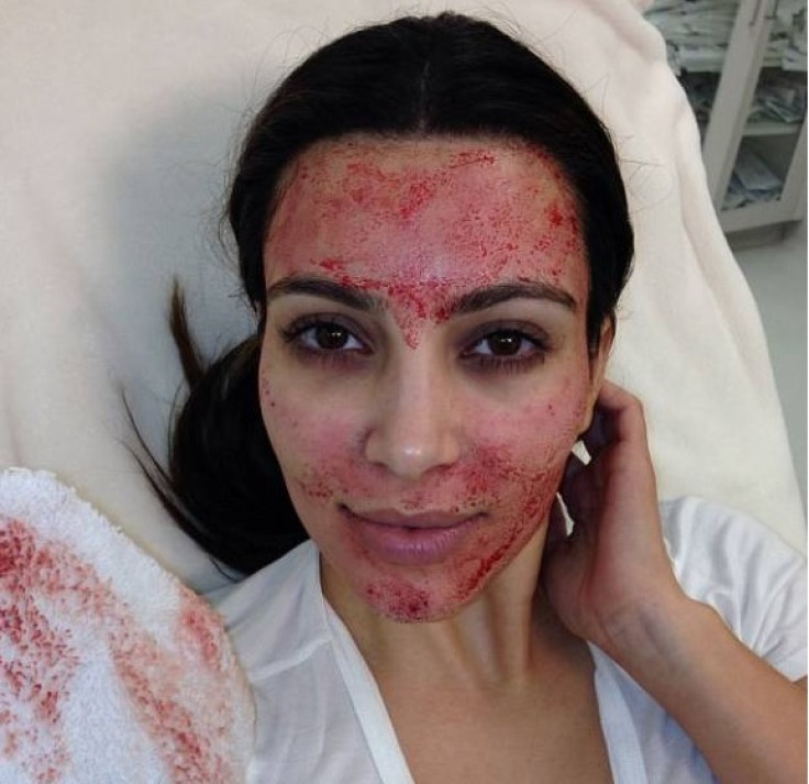 Kim Kardashian bloody facial selfie