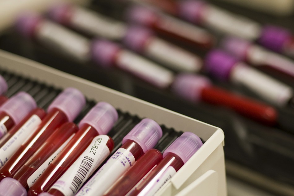 why-british-mps-are-urging-doctors-to-conduct-more-blood-cancer-tests