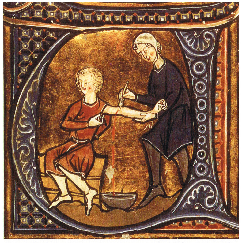 bloodletting