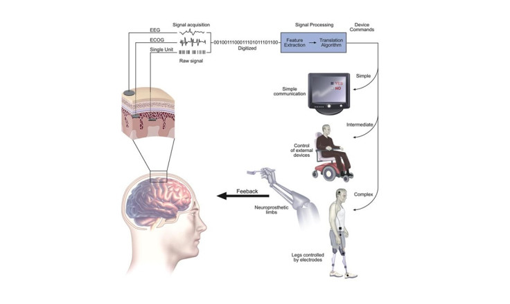 neuroprosthetics prosthetics neural brain control