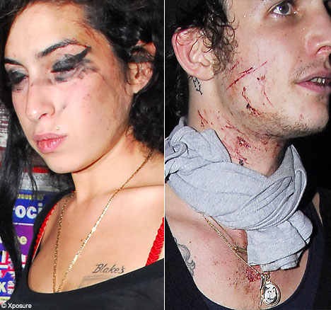 Amy Winehouse and Blake Fielder Civil after a fight related to drugs